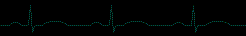 GIF animado (62037) Cardiograma