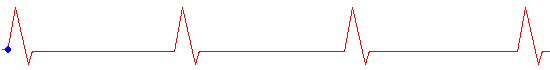 GIF animado (62039) Linea del cardiograma