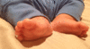 GIF animado (70206) Pies recien nacido