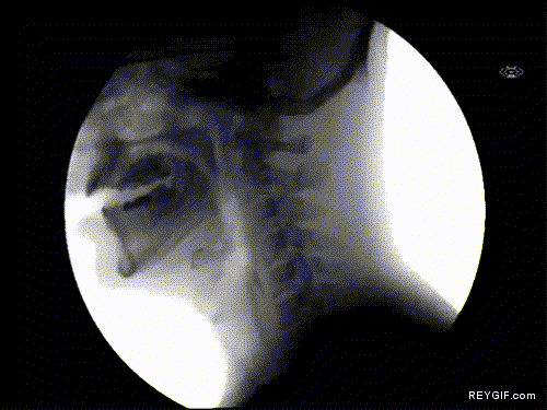 GIF animado (88817) Tomando agua desde los rayos x